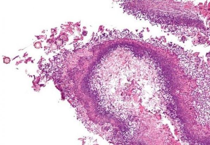 10 самых опасных бактерий в мире