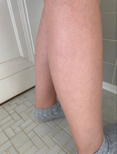 Особенности женской внешности, из-за которых многие переживают — и совершенно зря