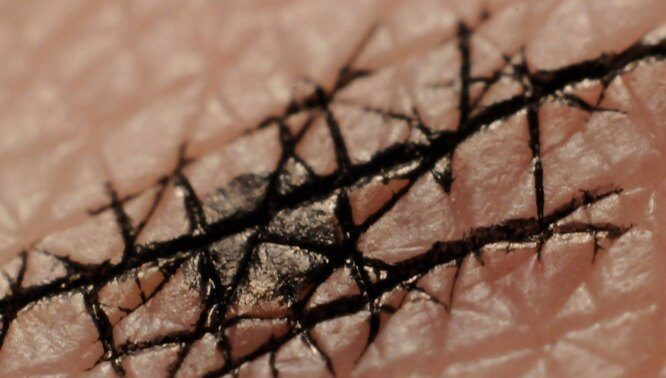 10 потрясающих макроснимков, которые раскроют для вас невероятный микромир