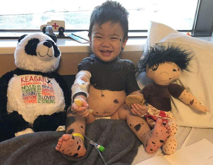 «Кукла, как я»: Волонтёр шьёт уникальных кукол для детей с физическими особенностями