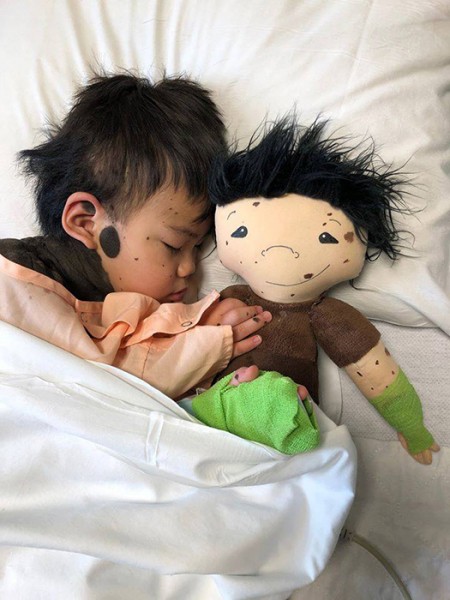 «Кукла, как я»: Волонтёр шьёт уникальных кукол для детей с физическими особенностями