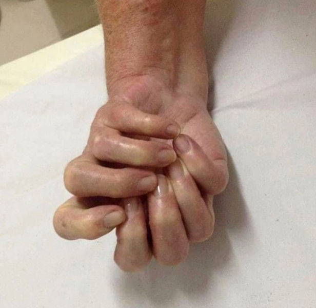 Особенные: 10 необычных аномалий человеческого тела