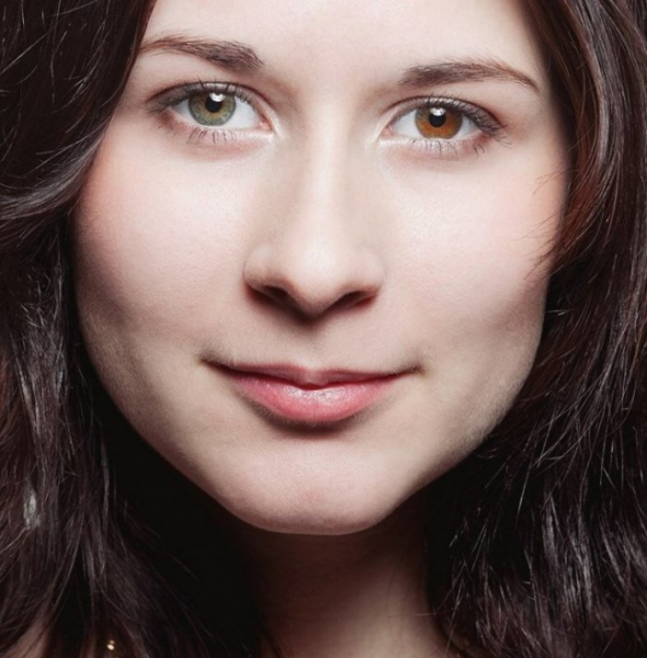 Особенные: 10 необычных аномалий человеческого тела