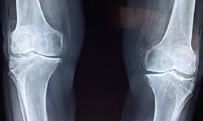 10 удивительных малоизвестных фактов о человеческом теле