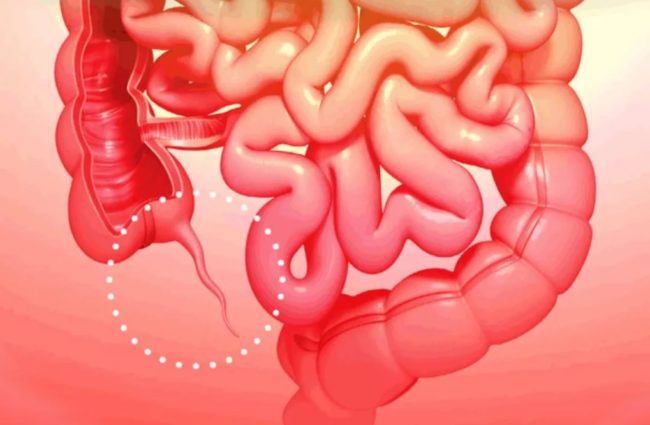 9 частей человеческого организма, ставших ненужными в ходе эволюции