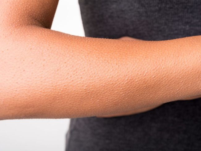 9 частей человеческого организма, ставших ненужными в ходе эволюции