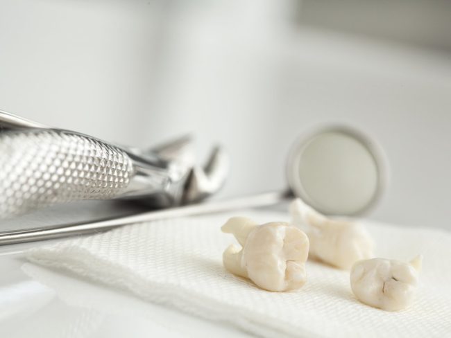 9 частей человеческого организма, ставших ненужными в ходе эволюции