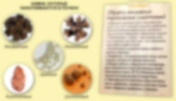 Камни в почках у женщин - симптомы и лечение