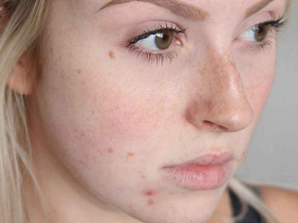 Жидкая бомба с эффектом 3-дневного голодания! Избавься от токсинов, головных болей и усталости. Чувствую себя перышком. Жидкая бомба с эффектом 3-дневного голодания! Избавься от токсинов, головных болей и усталости. Чувствую себя перышком.