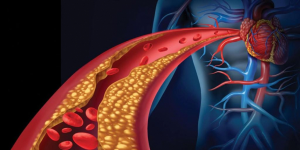 Как снизить холестерин в крови у женщин: народные средства и лекарственные препараты. Чистка организма от шлаков и токсинов Как снизить холестерин в крови у женщин: народные средства и лекарственные препараты. Чистка организма от шлаков и токсинов