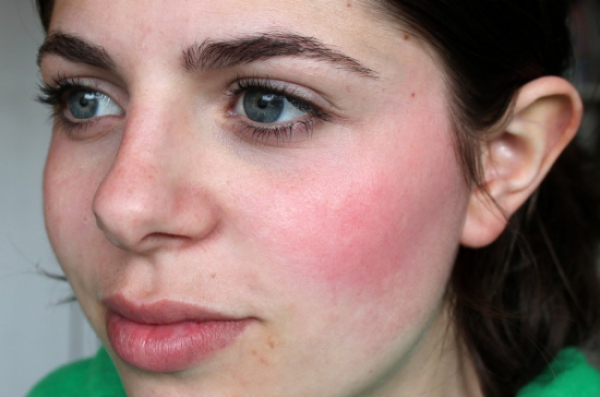 Как распознать по лицу проблемы со здоровьем