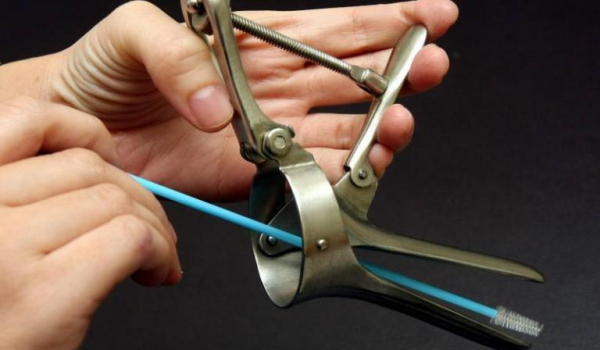 Мазок на микрофлору у женщин: что показывает, расшифровка результатов Мазок на микрофлору у женщин: что показывает, расшифровка результатов