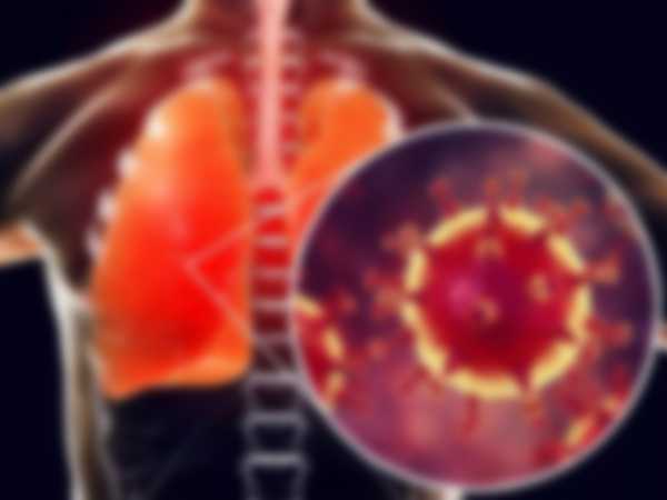 Жжение в грудной клетке при коронавирусе Жжение в грудной клетке при коронавирусе