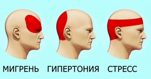 Как избавиться от головной боли без таблеток за 5 минут Как избавиться от головной боли без таблеток за 5 минут