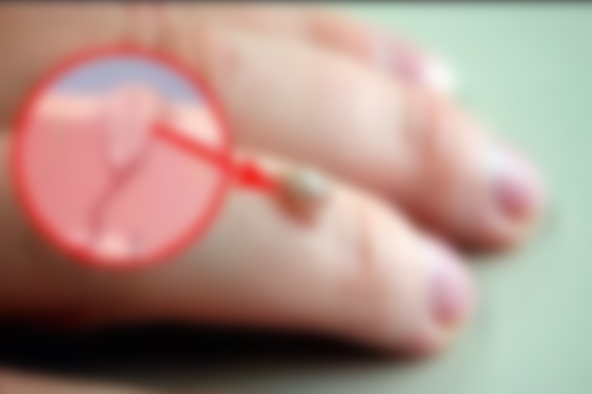 Уплотнение под кожей в виде шарика Уплотнение под кожей в виде шарика