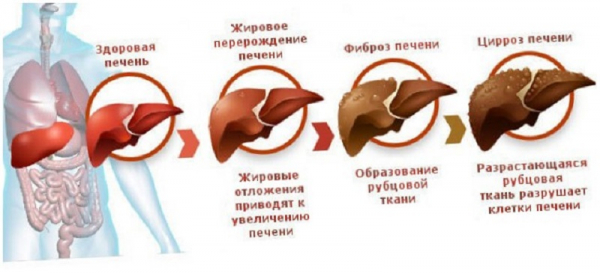 Чистим печень, худеем, обновляем клетки организма! 72 часа и пару чашечек&hellip;