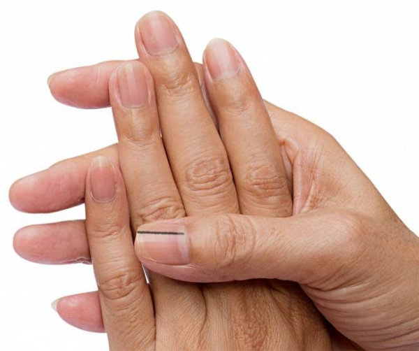 7 совершенно незначительных вещей, которые могут быть сигналом опасной болезни 7 совершенно незначительных вещей, которые могут быть сигналом опасной болезни