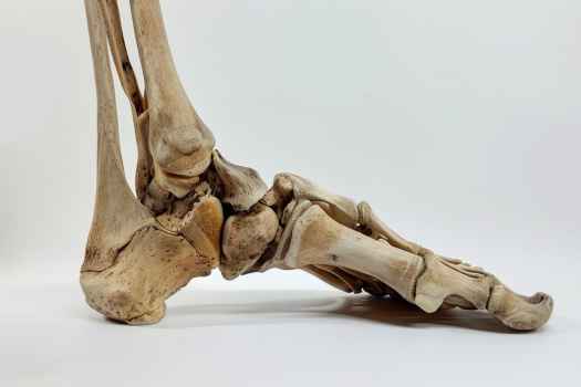 Шишки на пальцах ног: причины, симптомы и методы лечения Шишки на пальцах ног: причины, симптомы и методы лечения