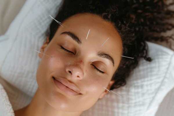 Иглоукалывание: польза и вред, медицинские показания к процедуре Иглоукалывание: польза и вред, медицинские показания к процедуре