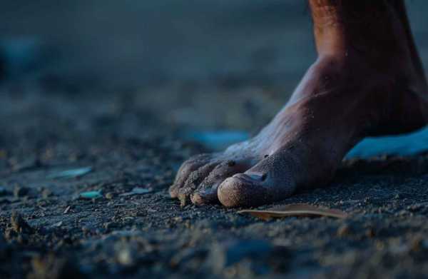 Шишки на пальцах ног: причины, симптомы и методы лечения Шишки на пальцах ног: причины, симптомы и методы лечения