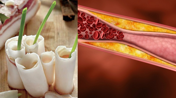 Вот что происходит с организмом, когда ты ешь сало. Не упади со стула!