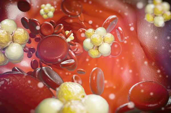 Как понизить холестерин без лекарств: 5 простых привычек Как понизить холестерин без лекарств: 5 простых привычек