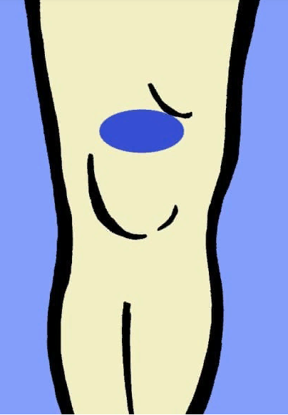 5 основных причин, почему болят колени 5 основных причин, почему болят колени