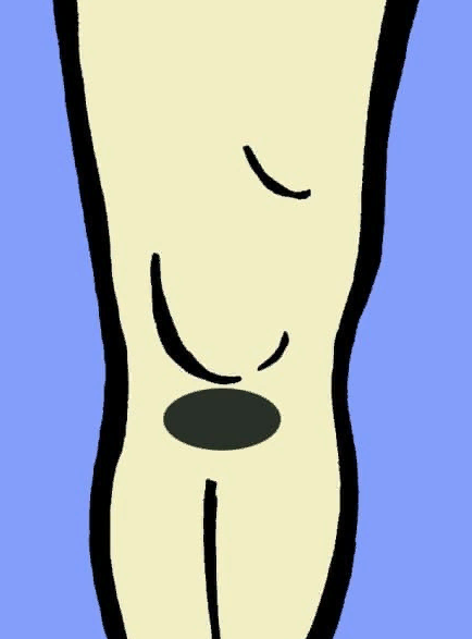 5 основных причин, почему болят колени 5 основных причин, почему болят колени