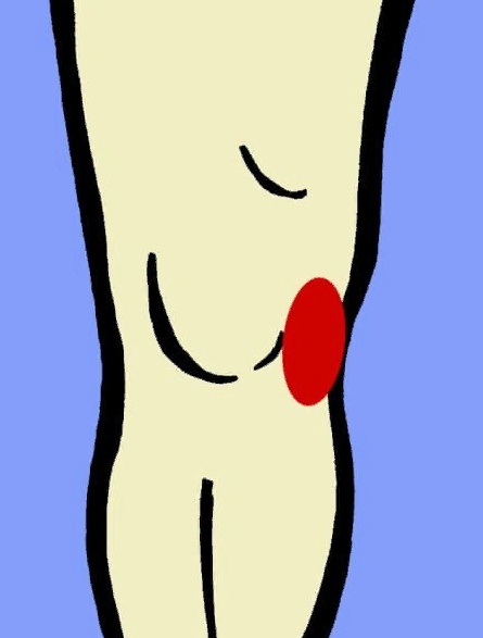 5 основных причин, почему болят колени 5 основных причин, почему болят колени